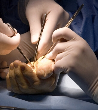 handsurgeryimg - Dr Cameron Mackay